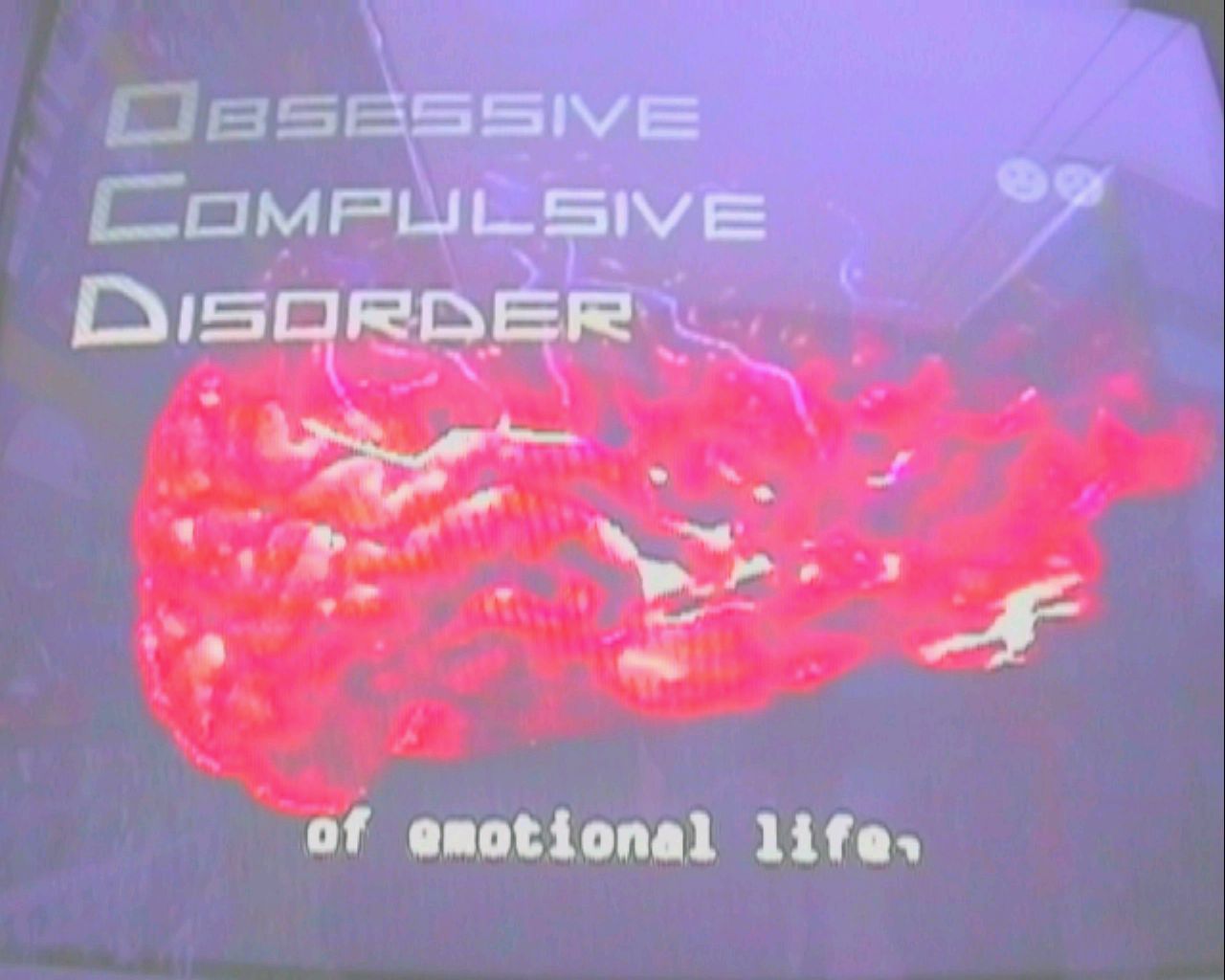 DISORDINE OSSESSIVO COMPULSIVO